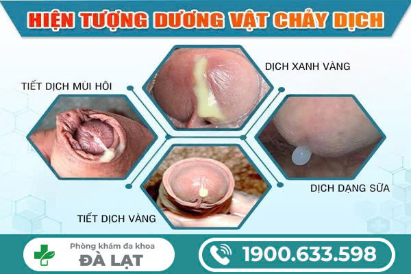 Hình ảnh minh họa